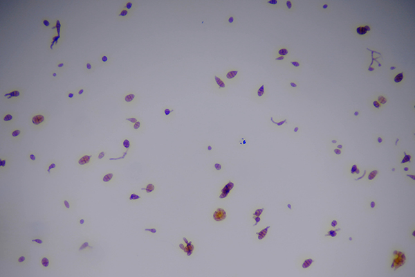 遠(yuǎn)程拍照式孢子捕捉儀圖片4 遠(yuǎn)程拍照式孢子捕捉儀圖片4